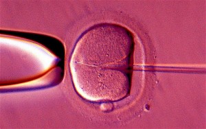 IVF_2355941b